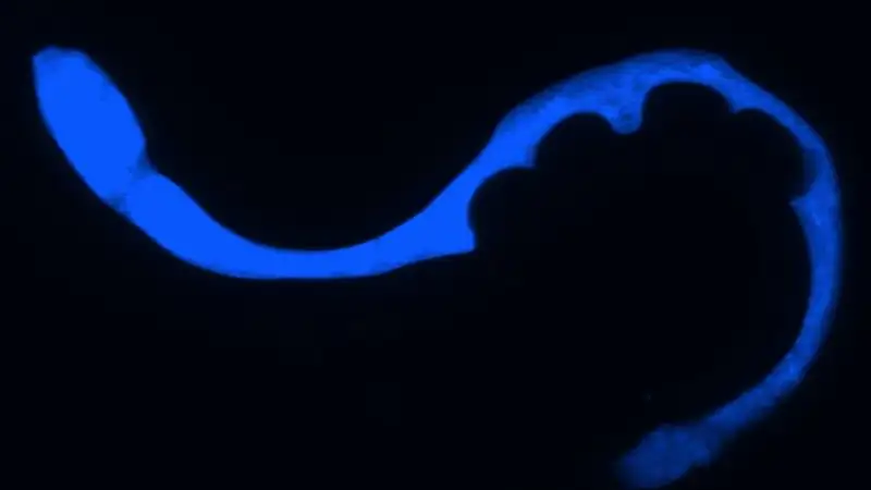 The worm that glows blue when it dies