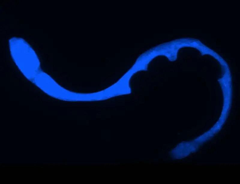 The worm that glows blue when it dies